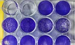 साइंटिस्ट क्यों कर रहे हैं खौफ़नाक कोरोना वायरस का कल्चर !