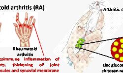 वैज्ञानिकों ने चिटोसन के साथ नैनोपार्टिकल का किया प्रतिपादन