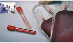 प्लाज्मा जुटाने के लिए ठीक हुए मरीजों को भेजे जाएंगे दान के मैसेज प्लाज्मा जुटाने के लिए ठीक हुए मरीजों को भेजे जाएंगे दान के मैसेज