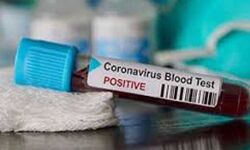 राजस्थान में कोरोना संक्रमित मरीजों की संख्या एक लाख एक हजार से अधिक पहुंची राजस्थान में कोरोना संक्रमित मरीजों की संख्या एक लाख एक हजार से अधिक पहुंची