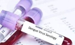 पूर्व मंत्री की पुत्रवधु की अकाल मौत - जाने वजह