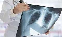 सही पोषण और दवा सब सुविधा उपलब्ध- होगा टी0 बी0 मुक्त उत्तर प्रदेश सही पोषण और दवा सब सुविधा उपलब्ध- होगा टी0 बी0 मुक्त उत्तर प्रदेश