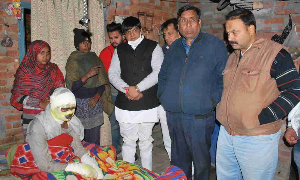 आग से झुलसे युवक के घर पहुंचकर समाजसेवी ने दी खाद्य सामग्री