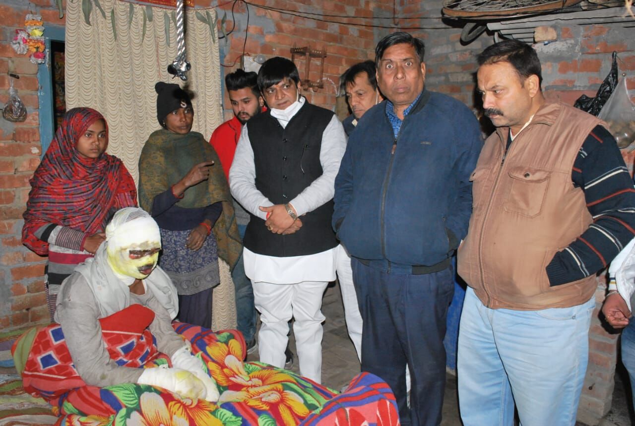 आग से झुलसे युवक के घर पहुंचकर समाजसेवी ने दी खाद्य सामग्री