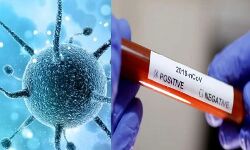 सार्स-सीओवी-2 के रोकथाम के लिए बनाई रणनीति सार्स-सीओवी-2 के रोकथाम के लिए बनाई रणनीति