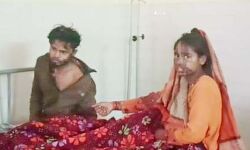 नवदंपत्ति पर मामा ने डाला तेजाब - FIR हुई दर्ज