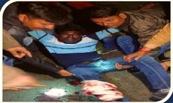 पुलिस मुठभेड़ में घायल बदमाश गिरफ्तार