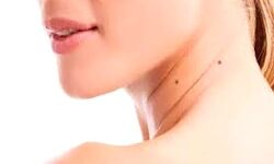 यहां हों तिल- तो बनाता है धनवान, तीव्र बुद्धिमान