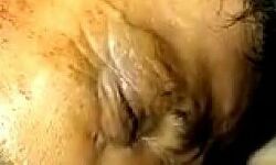 होमगार्ड पर जानलेवा हमला- ट्रामा सेंटर रेफर होमगार्ड पर जानलेवा हमला- ट्रामा सेंटर रेफर