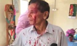 शिक्षक ने हथौड़ा मारकर फोड़ा प्रिंसिपल का सिर