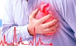 दिल का दौरा पड़ने से राष्ट्रपति का निधन