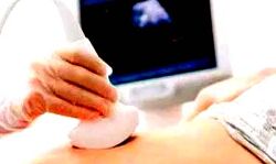 भ्रूण लिंग जांच करने वाले गिरोह का पर्दाफाश- 8 गिरफ्तार भ्रूण लिंग जांच करने वाले गिरोह का पर्दाफाश- 8 गिरफ्तार