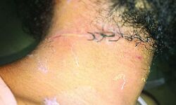 जा रहा था बीमार बहन के पास- आया चायनीज मांझा- काट दी गर्दन जा रहा था बीमार बहन के पास- आया चायनीज मांझा- काट दी गर्दन