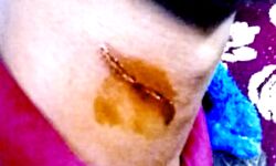 मांझा बना काल- मासूम की गर्दन काटी मांझा बना काल- मासूम की गर्दन काटी