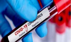 7 चिकित्सक समेत 12 कर्मचारी कोरोना संक्रमित