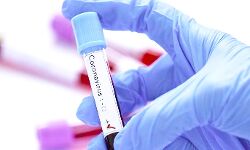 चिकित्सक व पत्रकार सहित मिले 151 पॉजिटिव चिकित्सक व पत्रकार सहित मिले 151 पॉजिटिव