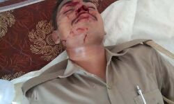 पंचायत चुनाव- वाहन पलटा, 7 पुलिसकर्मी घायल पंचायत चुनाव- वाहन पलटा, 7 पुलिसकर्मी घायल