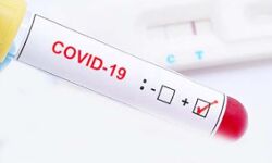 कोरोना पॉजिटिव निकले प्रत्याशियों की लिस्ट गांव में की जाएगी चस्पा: DM