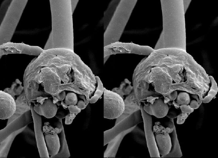 ब्लैक फंगस महामारी घोषित- राज्य में मिले 700 मरीज ब्लैक फंगस महामारी घोषित- राज्य में मिले 700 मरीज