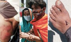 युवक ने नहीं पहना था मास्क-पुलिस ने हाथ पैर में ठोंकी कील युवक ने नहीं पहना था मास्क-पुलिस ने हाथ पैर में ठोंकी कील