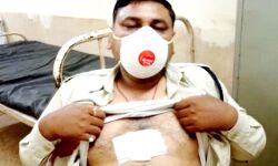 पुलिसकर्मी पर चाकू से हमला- लॉकडाउन में फल बेचने से रोका था