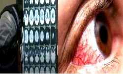 नही थम रही आफत-अब ब्लैक फंगस के इतने सारे मामले नही थम रही आफत-अब ब्लैक फंगस के इतने सारे मामले