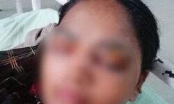 छेड़छाड़ के विरोध पर गर्म चाकू से दाग दी महिला की आंखें छेड़छाड़ के विरोध पर गर्म चाकू से दाग दी महिला की आंखें