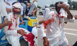 प्रदर्शन कर रहे किसानों पर पुलिस का लाठीचार्ज-अन्नदाताओं के सिर फूटे प्रदर्शन कर रहे किसानों पर पुलिस का लाठीचार्ज-अन्नदाताओं के सिर फूटे