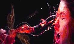 घर के बाहर सो रहे भाई-बहन पर सिरफिरे ने फेंका तेजाब घर के बाहर सो रहे भाई-बहन पर सिरफिरे ने फेंका तेजाब