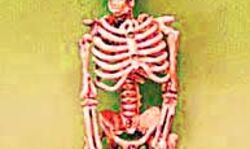 अस्पताल में बन्द पड़ी लिफ्ट में नर कंकाल मिलने से सनसनी