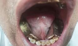 मुंह में रखकर ला रहा था करीब 1 किलो सोना- तलाशी में गया पकड़ा मुंह में रखकर ला रहा था करीब 1 किलो सोना- तलाशी में गया पकड़ा