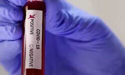 भोपाल में कोरोना के तीन नए मामले आये सामने भोपाल में कोरोना के तीन नए मामले आये सामने