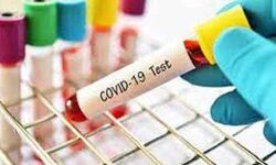 कोरोना के 80 नये मामले, तीन की मौत कोरोना के 80 नये मामले, तीन की मौत