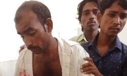 रात को सपने में पिटे युवक ने दिन निकलते ही पड़ोसी को जख्मी कर लिया बदला रात को सपने में पिटे युवक ने दिन निकलते ही पड़ोसी को जख्मी कर लिया बदला