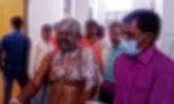 नहीं हुई इच्छापूर्ति- नपुंसक पति पर डाला उबलता तेल- बुरी तरह झुलसा नहीं हुई इच्छापूर्ति- नपुंसक पति पर डाला उबलता तेल- बुरी तरह झुलसा