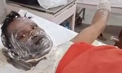 अधिकारियों ने नही की सुनवाई- किसान ने विधानसभा के सामने आग लगाई अधिकारियों ने नही की सुनवाई- किसान ने विधानसभा के सामने आग लगाई