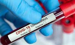 कोरोना के 28 नये मामले तीन की मौत कोरोना के 28 नये मामले तीन की मौत