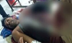 मजदूरी के पैसे मांगने पर मजूदर का काट दिया हाथ मजदूरी के पैसे मांगने पर मजूदर का काट दिया हाथ