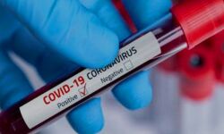 कोरोना का कहर जारी- सात गर्भवती महिलाएं कोरोना पॉजिटिव कोरोना का कहर जारी- सात गर्भवती महिलाएं कोरोना पॉजिटिव