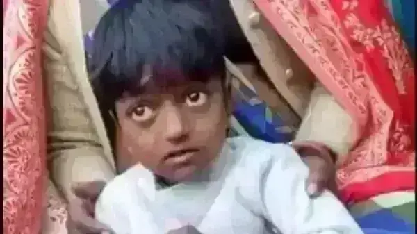 महिला ने अपने बच्चे को सियार के हमले से बचाया, बच्चा अस्पताल में भर्ती महिला ने अपने बच्चे को सियार के हमले से बचाया, बच्चा अस्पताल में भर्ती