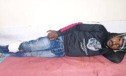 मुठभेड़ में पुलिस ने किया दो शातिर लुटेरों को लंगड़ा