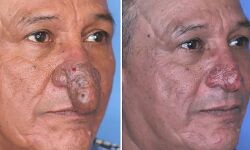 प्राइवेट पार्ट जैसी दिखने की वजह से चिढ़ाते थे लोग डॉक्टर ने किया सॉल्यूशन प्राइवेट पार्ट जैसी दिखने की वजह से चिढ़ाते थे लोग डॉक्टर ने किया सॉल्यूशन