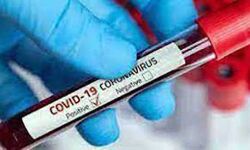 इलाके में मिले कोरोना के 53 नए मामले - एक व्यक्ति की हुई मौत इलाके में मिले कोरोना के 53 नए मामले - एक व्यक्ति की हुई मौत