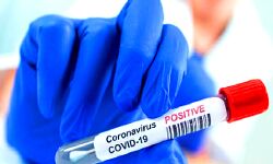 जनता दरबार में मिले दर्जनों कोरोना पॉजिटिव-CM के गले में भी खराश जनता दरबार में मिले दर्जनों कोरोना पॉजिटिव-CM के गले में भी खराश