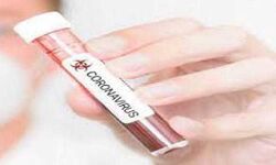 पिछले 24 घंटों में कोरोना वायरस के नये मामले कई लोगो मौत पिछले 24 घंटों में कोरोना वायरस के नये मामले कई लोगो मौत