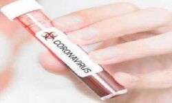 कोरोना के नये मरीज मिले कई मरीज़ ठीक एक की मौत कोरोना के नये मरीज मिले कई मरीज़ ठीक एक की मौत