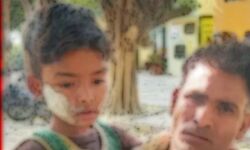 बेरहम मां की निर्दयी दास्तान- खाना मांगने पर बेटे का मुंह जलाया बेरहम मां की निर्दयी दास्तान- खाना मांगने पर बेटे का मुंह जलाया