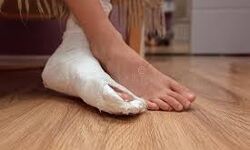 लापरवाही - फ्रैक्चर बायें पैर में और ऑपरेशन कर दिया दायें पैर का लापरवाही - फ्रैक्चर बायें पैर में और ऑपरेशन कर दिया दायें पैर का