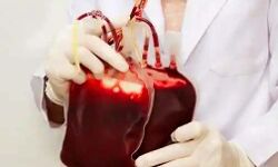 इंसान की खून में पहली बार मिले प्लास्टिक के टुकडे-वैज्ञानिक हुए हैरान इंसान की खून में पहली बार मिले प्लास्टिक के टुकडे-वैज्ञानिक हुए हैरान