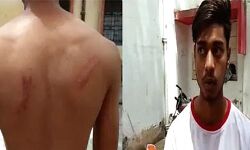 सिपाहियों ने बंद कमरे ले जाकर छात्र को पीटा- दी एनकाउंटर करने की धमकी सिपाहियों ने बंद कमरे ले जाकर छात्र को पीटा- दी एनकाउंटर करने की धमकी